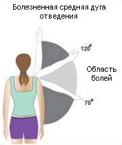 impidjment_04.jpg impidjment_04.jpg