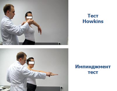 impidjment_05.jpg impidjment_05.jpg